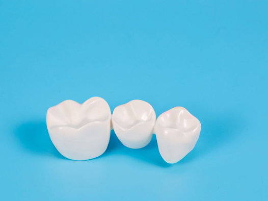 dental bridges in milpitas dental bridges in milpitas