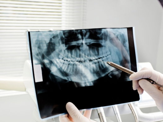 oral cancer exam in milpitas oral cancer exam in milpitas