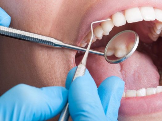 dental cleaning in milpitas ca dental cleaning in milpitas ca