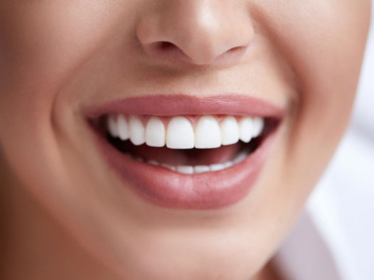 Teeth Whitening Teeth Whitening