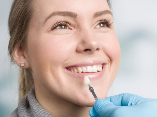 woman with beautiful veneers woman with beautiful veneers